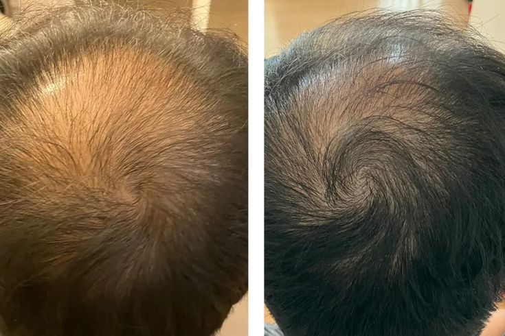 Organic Aura - 8-in-1 Signature Hair Oil with Rosemary & Kalonji (Lab Tested)