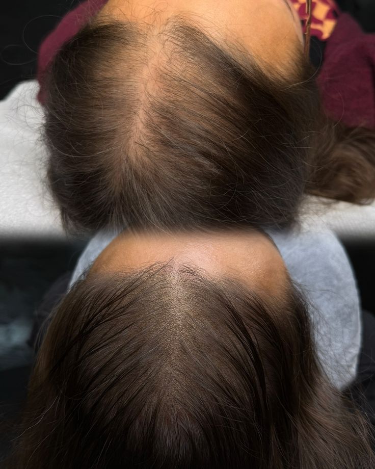 Organic Aura: Herbal Hair Growth Shampoo