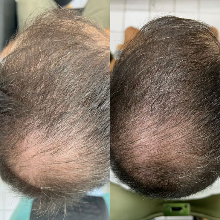 Organic Aura: Herbal Hair Growth Shampoo
